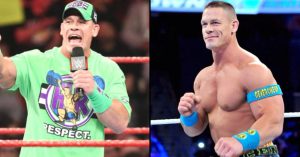 did john cena get a hair transplant