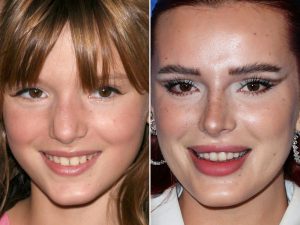 bella thorne nose job