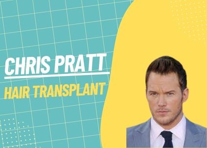 Chris Pratt Hair Transplant: A Comprehensive Analysis