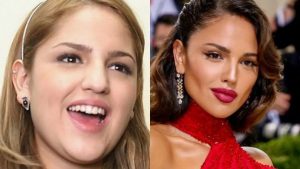 eiza gonzalez rhinoplasty