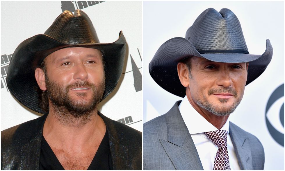 tim-mcgraw-facelift