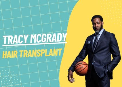 Tracy McGrady Hair Transplant: What’s the Real Story?
