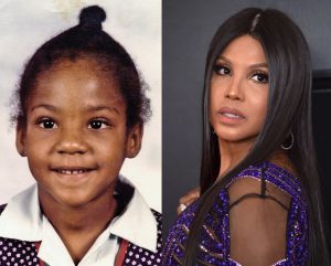 toni braxton nose job