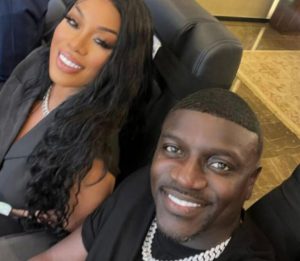 Akon-hair-transplant