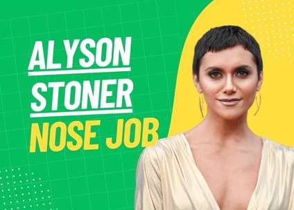 Alyson Stoner Nose Job