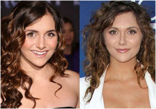 alyson stoner nose job