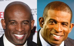Deion-Sanders-Hair-Transplant-Before-After