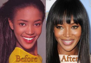 Naomi-Campbell-Nose-Job