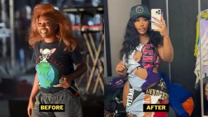 SZA-Plastic-Surgery
