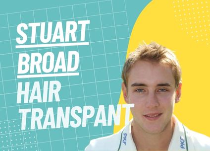 Stuart Broad’s Hair Transplant: A Comprehensive Analysis