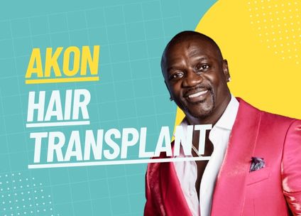 Akon’s Hair Transplant