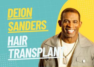 deion sanders hair transplant