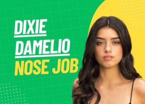 dixie damelio nose job featured cover image