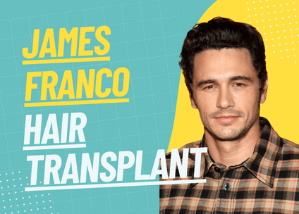 James Franco Hair Transplant: Separating Fact from Fiction