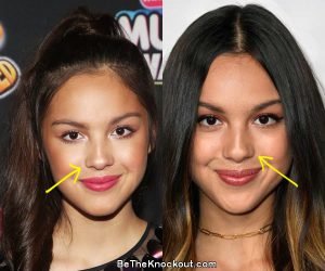 olivia-rodrigo-nose-job