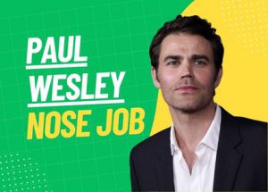 paul wesley nose job featured image