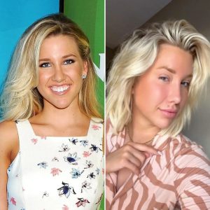 savannah chrisley nose before after