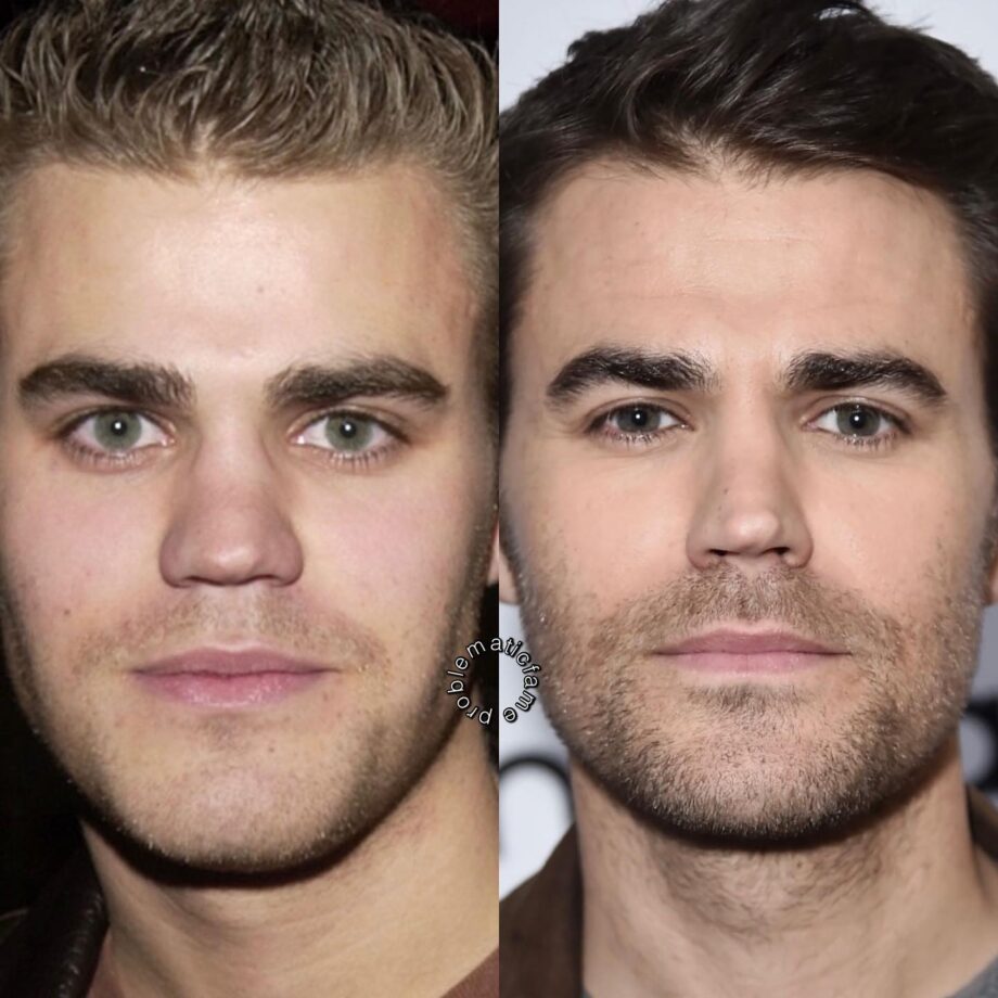 paul wesley rhinoplasty