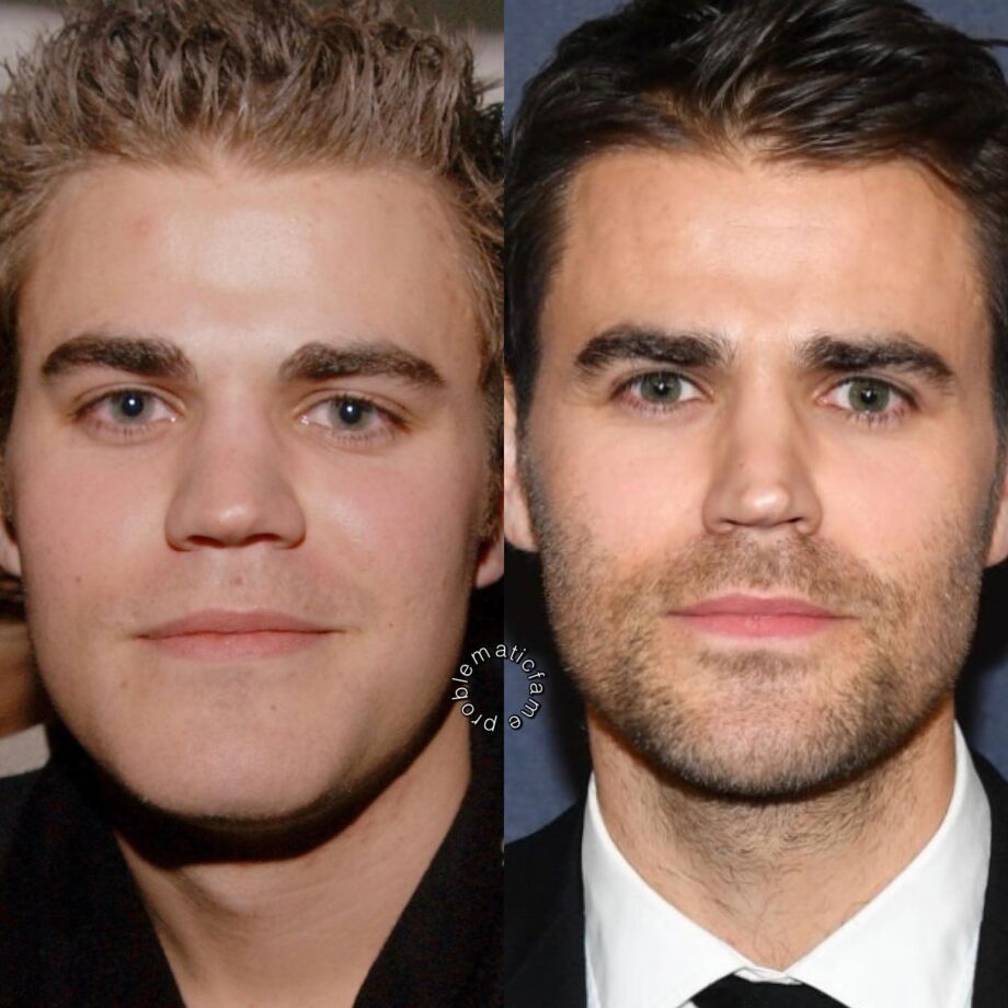 paul wesley nose surgery