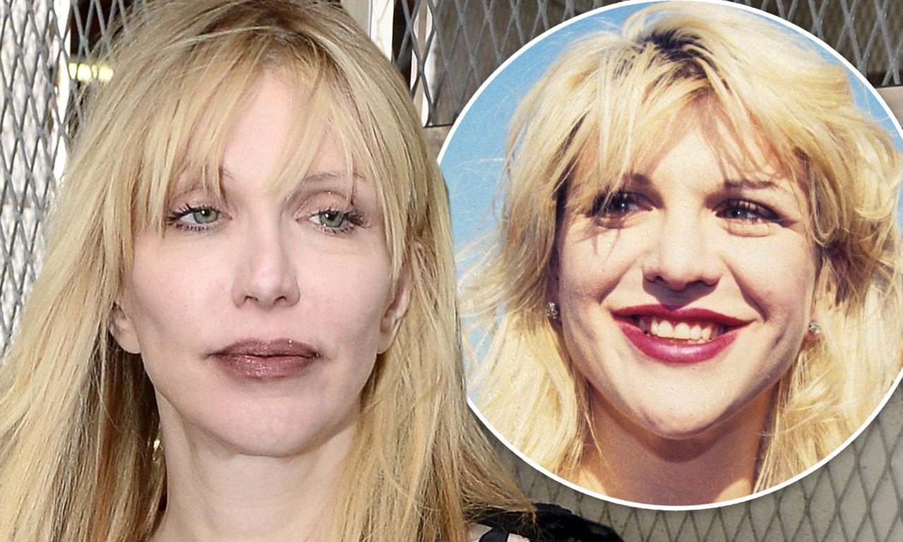 Courtney Love Nose Job