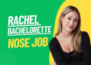 rachel bachelorette nose job featured image