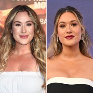 rachel bachelorette nose job