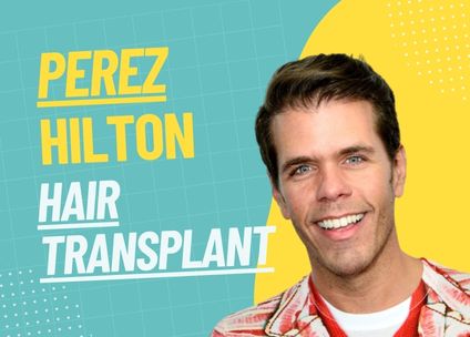 Perez Hilton Hair Transplant