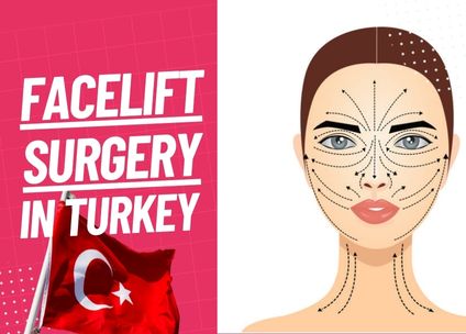 Facelift Surgery Turkey