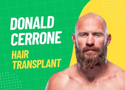 Donald Cerrone Hair Transplant