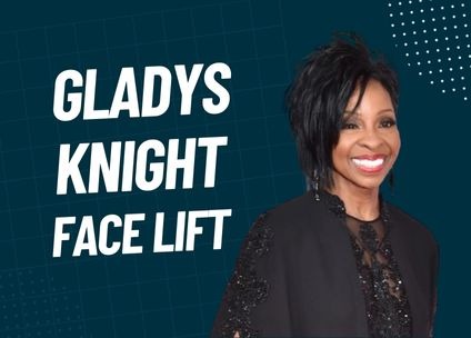Gladys Knight Face Lift