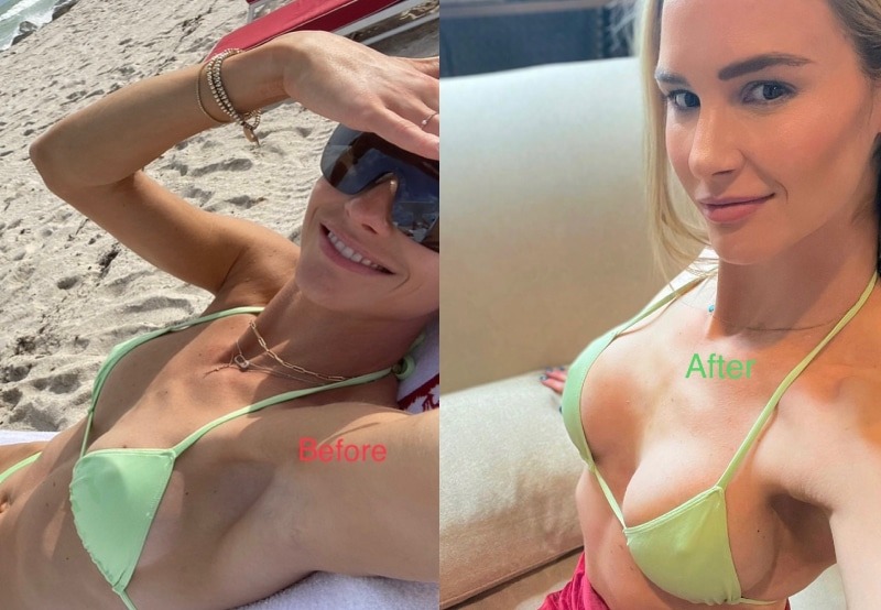Meghan-King-Before-And-After-Boob-Job