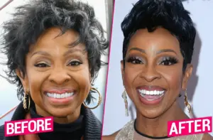Gladys-Knight-Face-Lift-before-after.jpg