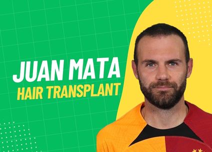 Juan Mata Hair Transplant
