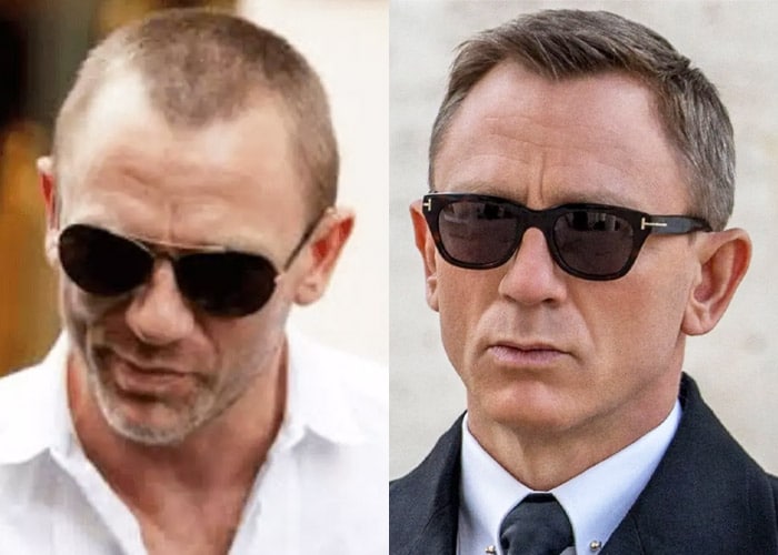 Daniel Craig hair loss