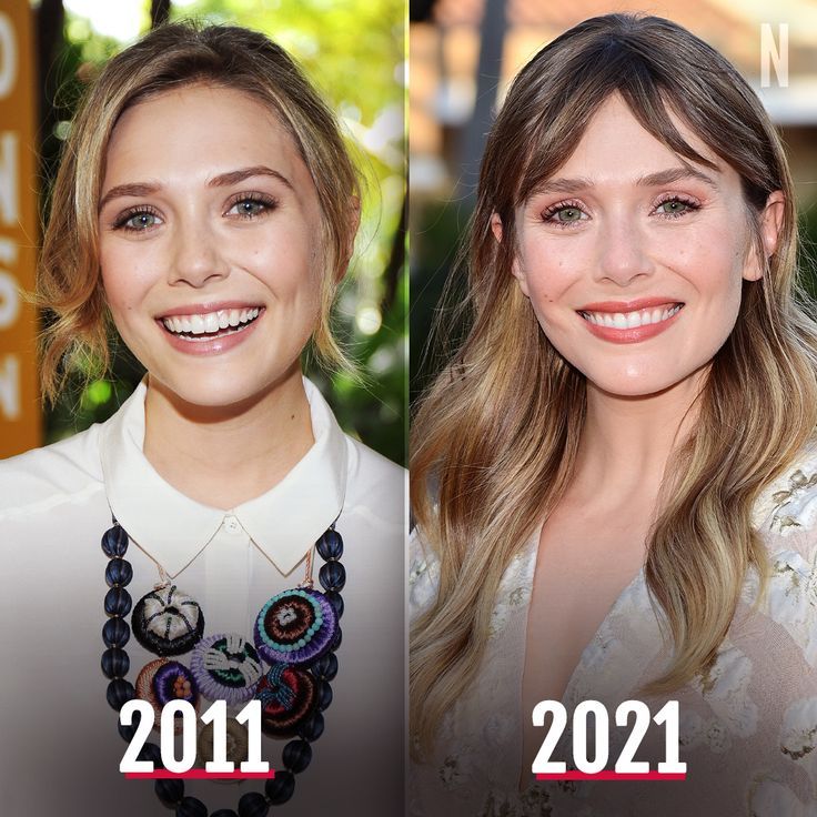 Elizabeth Olsen Nose Job