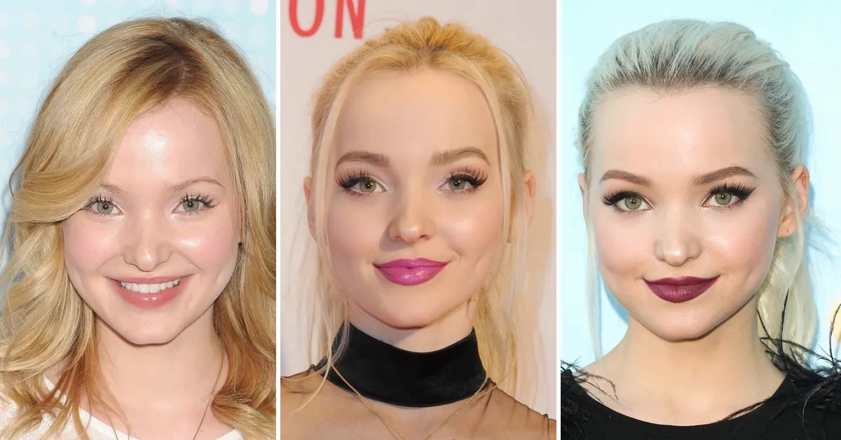 dove-cameron-evolution-plastic-surgery