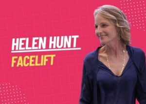 helen hunt facelift