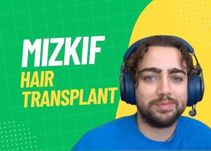Mizkif Hair Transplant – Everything You Need to Know