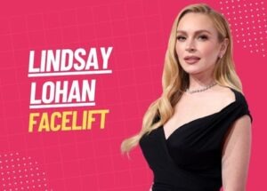 lindsay lohan facelift