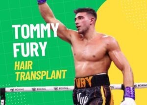 tommy fury hair transplant