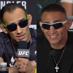 tony ferguson hair transplant