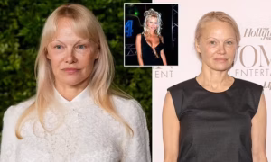 Pamela Anderson Facelift