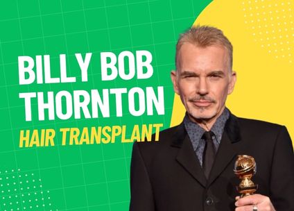 Billy Bob Thornton Hair Transplant