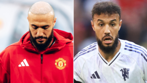 mazraoui hair transplant