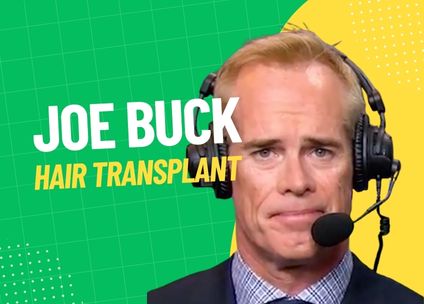 Joe Buck Hair Transplant