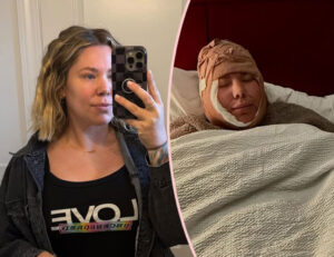 Kailyn Lowry Neck Lift procedure after