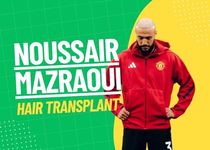mazraoui Hair Transplant