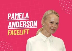 pamela anderson facelift